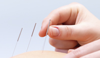 acupuncture_198x115